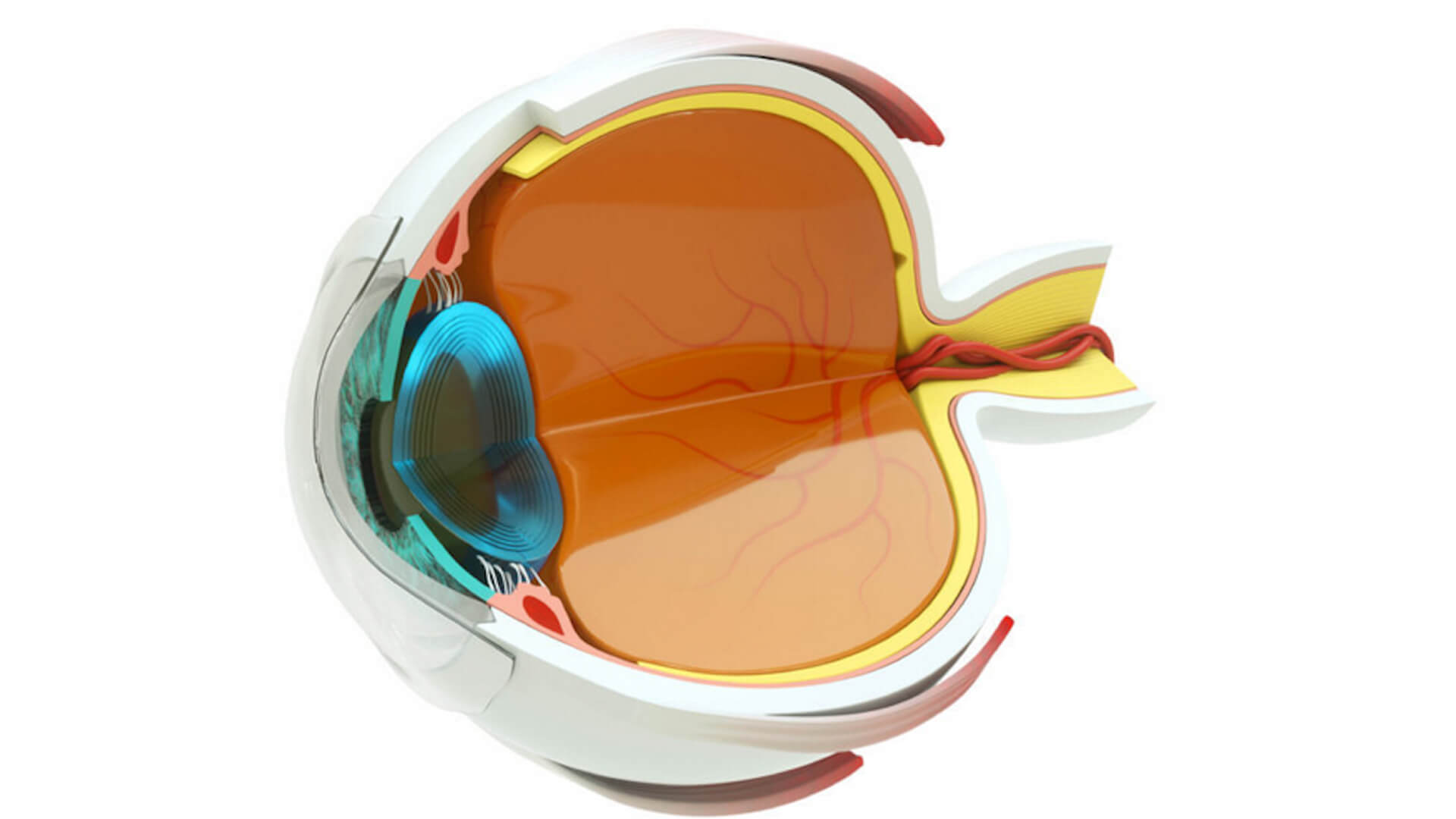 Cataract Lenses | Queensland Eye & Retina Specialists