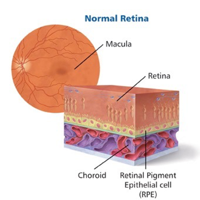 Age-related Macular Degeneration (AMD) | Queensland Eye & Retina Specialists